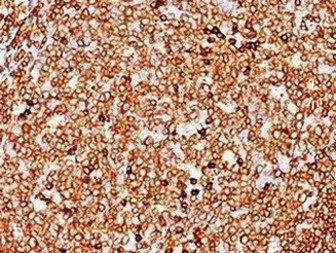 Immunohistochemistry (Formalin/PFA-fixed paraffin-embedded sections) - Anti-CD79a antibody [JCB117] - BSA and Azide free (AB213110), expandable thumbnail