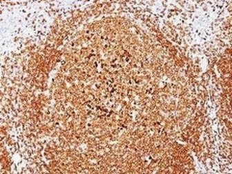 Immunohistochemistry (Formalin/PFA-fixed paraffin-embedded sections) - Anti-CD79a antibody [JCB117] - BSA and Azide free (AB213110), expandable thumbnail