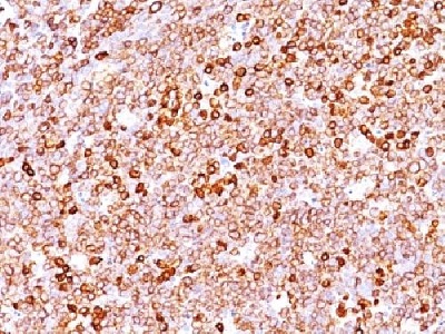 Immunohistochemistry (Formalin/PFA-fixed paraffin-embedded sections) - Anti-CD79a antibody [JCB117 + HM47/A9] - BSA and Azide free (AB213114), expandable thumbnail
