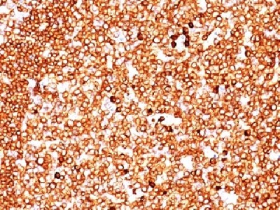 Immunohistochemistry (Formalin/PFA-fixed paraffin-embedded sections) - Anti-CD79a antibody [JCB117 + HM47/A9] - BSA and Azide free (AB213114), expandable thumbnail