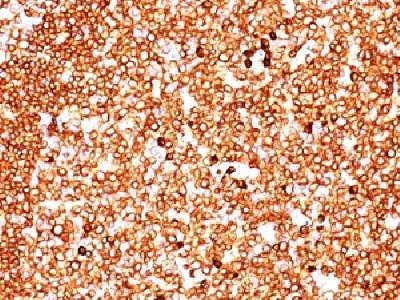 Immunohistochemistry (Formalin/PFA-fixed paraffin-embedded sections) - Anti-CD79a antibody [JCB117 + HM47/A9] - BSA and Azide free (AB213114)