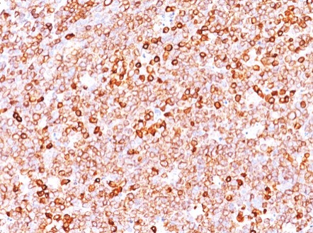 Immunohistochemistry (Formalin/PFA-fixed paraffin-embedded sections) - Anti-CD79a antibody [JCB117 + HM47A9] (AB199001), expandable thumbnail