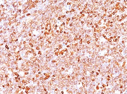 Immunohistochemistry (Formalin/PFA-fixed paraffin-embedded sections) - Anti-CD79a antibody [JCB117 + HM47A9] (AB199001)