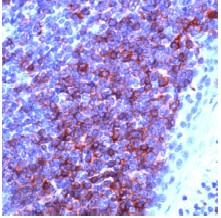 Immunohistochemistry (Formalin/PFA-fixed paraffin-embedded sections) - Anti-CD79a antibody, prediluted (AB27090)