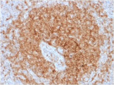 Immunohistochemistry (Formalin/PFA-fixed paraffin-embedded sections) - Anti-CD79a antibody [rIGA/764] (AB238096)