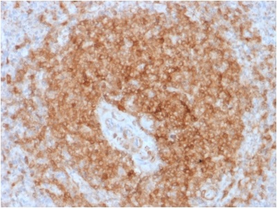 Immunohistochemistry (Formalin/PFA-fixed paraffin-embedded sections) - Anti-CD79a antibody [rIGA/764] - BSA and Azide free (AB237950)