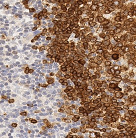 Immunohistochemistry (Formalin/PFA-fixed paraffin-embedded sections) - Anti-CD79a antibody [SP18] (AB16698)