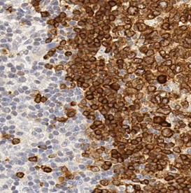 Anti-CD79a antibody [SP18] (ab16698) | Abcam