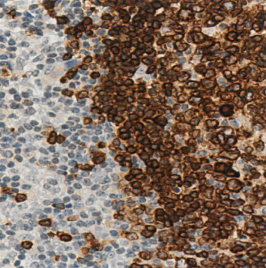 Immunohistochemistry (Formalin/PFA-fixed paraffin-embedded sections) - Anti-CD79a antibody [SP18] (AB16698)