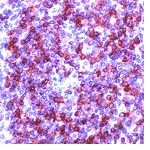Immunohistochemistry (Formalin/PFA-fixed paraffin-embedded sections) - Anti-CD79a antibody [SP18] (AB16698), expandable thumbnail