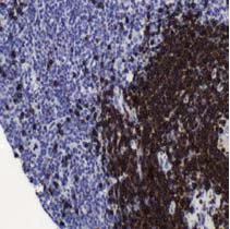 Immunohistochemistry (Formalin/PFA-fixed paraffin-embedded sections) - Anti-CD79a antibody [SP18], prediluted (AB27607)