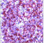 Immunohistochemistry (Formalin/PFA-fixed paraffin-embedded sections) - Anti-CD79a antibody [SP18], prediluted (AB27607), expandable thumbnail