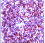 Immunohistochemistry (Formalin/PFA-fixed paraffin-embedded sections) - Anti-CD79a antibody [SP18], prediluted (AB27607)