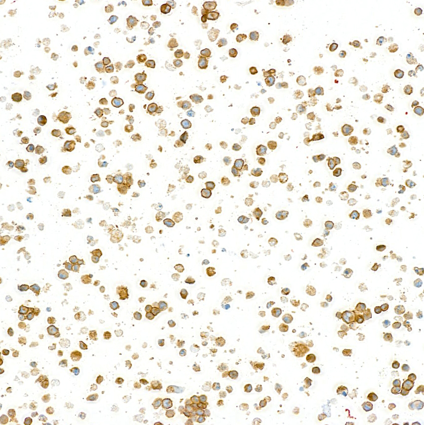 Immunocytochemistry - Anti-CD79B antibody [BLR229K] - BSA free (AB314044), expandable thumbnail