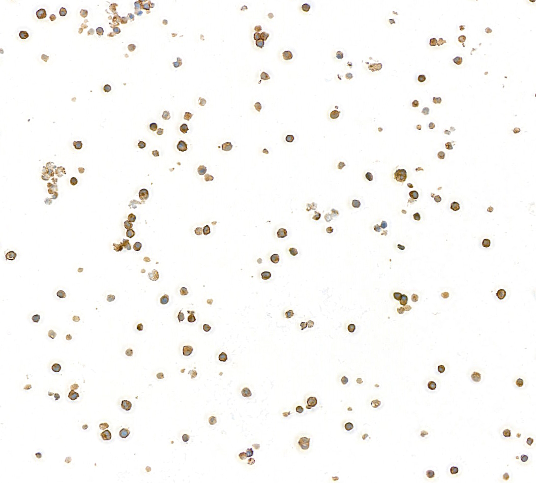 Immunocytochemistry - Anti-CD79B antibody [BLR229K] - BSA free (AB314044), expandable thumbnail
