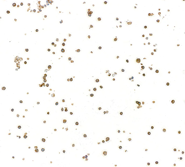 Immunocytochemistry - Anti-CD79B antibody [BLR229K] - BSA free (AB314044)