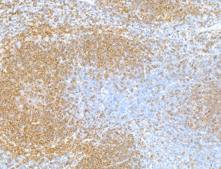 Immunohistochemistry (Formalin/PFA-fixed paraffin-embedded sections) - Anti-CD79B antibody [BLR229K] - BSA free (AB314044)