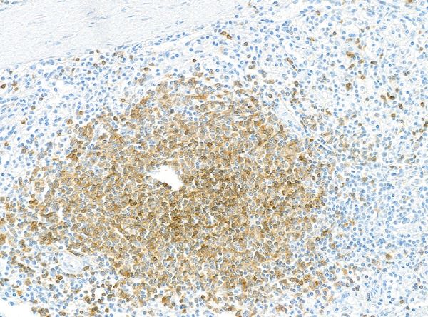 Immunohistochemistry (Formalin/PFA-fixed paraffin-embedded sections) - Anti-CD79B antibody [BLR229K] - BSA free (ab314044), expandable thumbnail