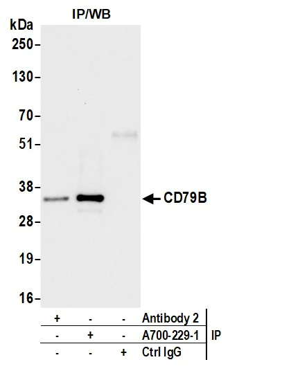 Immunoprecipitation - Anti-CD79B antibody [BLR229K] - BSA free (AB314044)