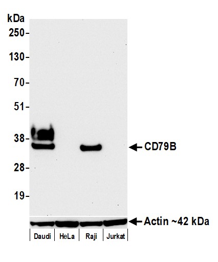 Western blot - Anti-CD79B antibody [BLR229K] - BSA free (AB314044), expandable thumbnail