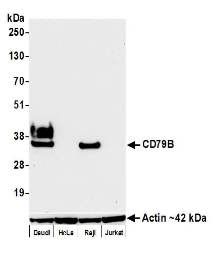Western blot - Anti-CD79B antibody [BLR229K] - BSA free (AB314044)