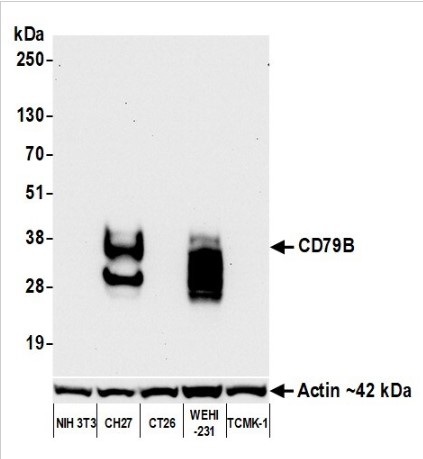Western blot - Anti-CD79B antibody [BLR229K] - BSA free (AB314044), expandable thumbnail