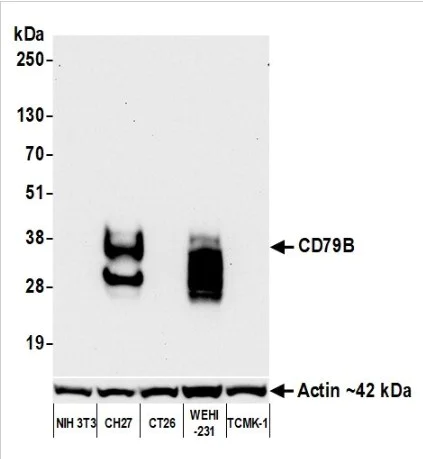 Western blot - Anti-CD79B antibody [BLR229K] - BSA free (AB314044)