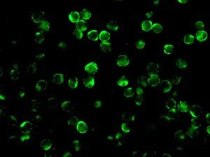 Immunocytochemistry/ Immunofluorescence - Anti-CD79b antibody [EPR6860] (AB134103)