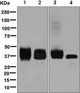 Western blot - Anti-CD79b antibody [EPR6860] (AB134103)