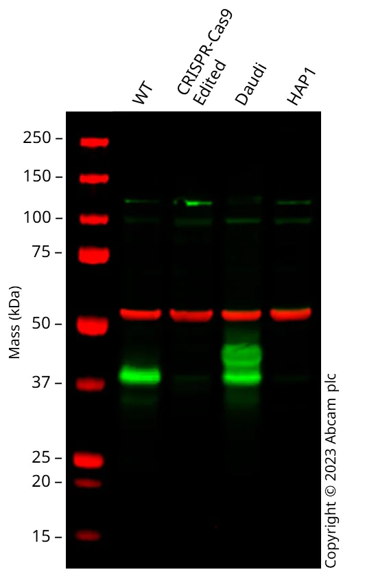Western blot - Anti-CD79b antibody [EPR6860] (AB134103)