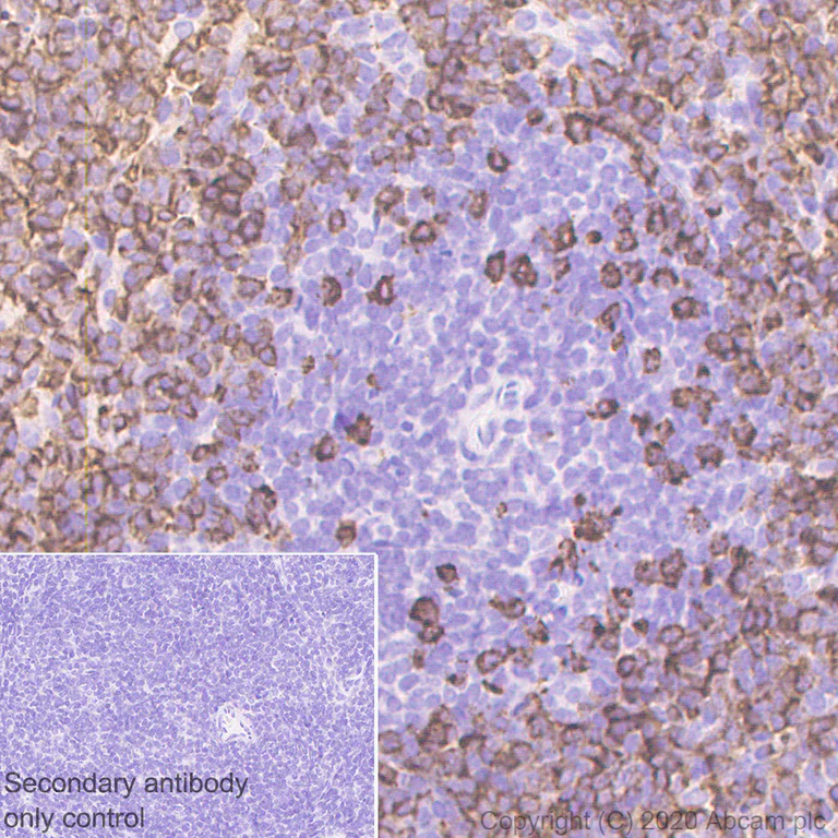 Immunohistochemistry (Formalin/PFA-fixed paraffin-embedded sections) - Anti-CD79b antibody [EPR6861] (AB134147)