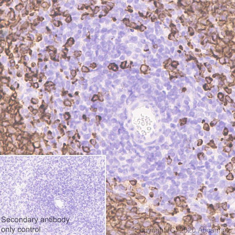 Immunohistochemistry (Formalin/PFA-fixed paraffin-embedded sections) - Anti-CD79b antibody [EPR6861] (AB134147)