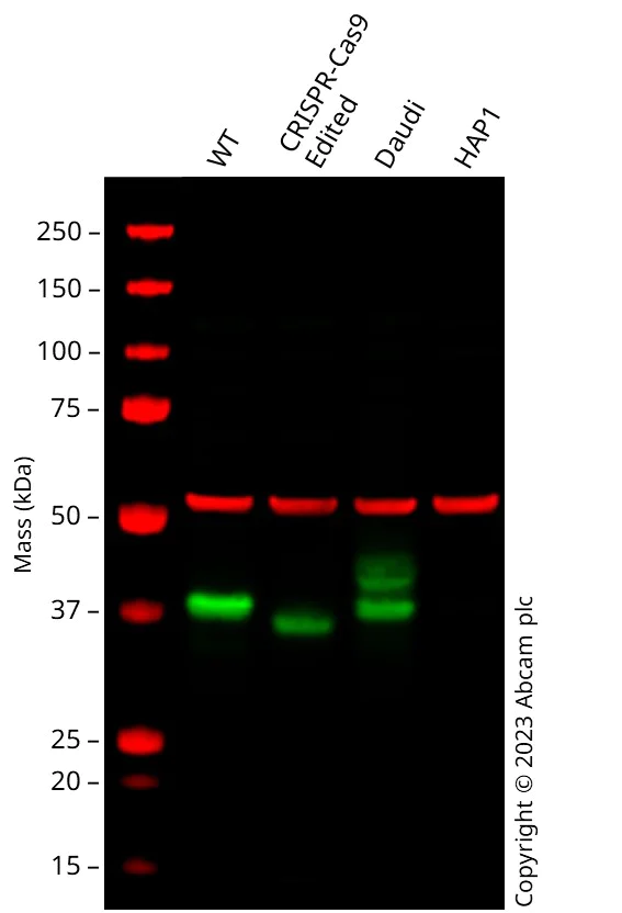 Western blot - Anti-CD79b antibody [EPR6861] (AB134147)