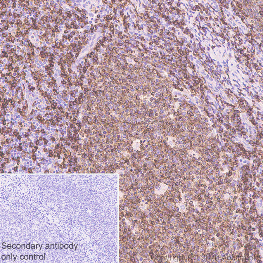 Immunohistochemistry (Formalin/PFA-fixed paraffin-embedded sections) - Anti-CD79b antibody [EPR6861] - BSA and Azide free (AB240083)