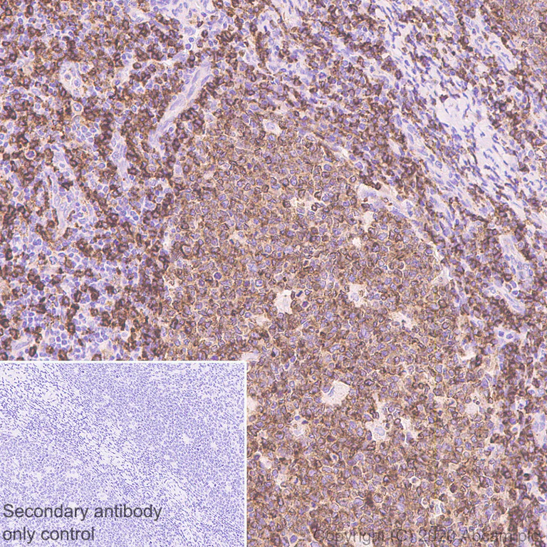 Immunohistochemistry (Formalin/PFA-fixed paraffin-embedded sections) - Anti-CD79b antibody [EPR6861] - BSA and Azide free (AB240083)