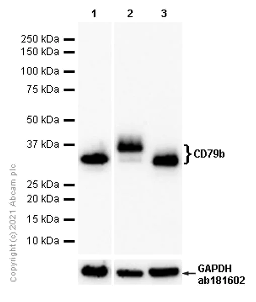 Western blot - Anti-CD79b antibody [EPR6861] - BSA and Azide free (AB240083)