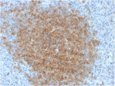 Immunohistochemistry (Formalin/PFA-fixed paraffin-embedded sections) - Anti-CD79b antibody [IGB/1844] - BSA and Azide free (AB237952)