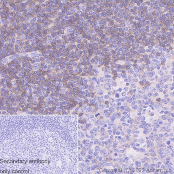 Immunohistochemistry (Formalin/PFA-fixed paraffin-embedded sections) - Anti-CD79b antibody [SP240] (AB183343)