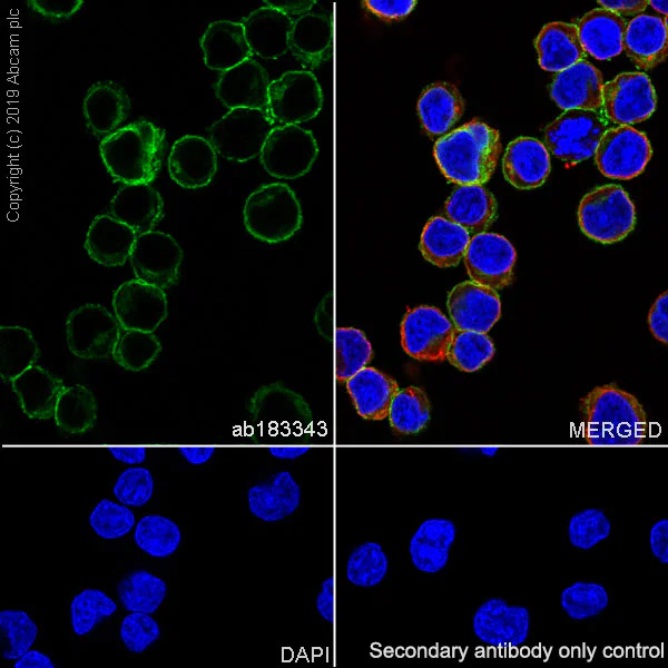 Immunocytochemistry/ Immunofluorescence - Anti-CD79b antibody [SP240] - BSA and Azide free (AB245745)