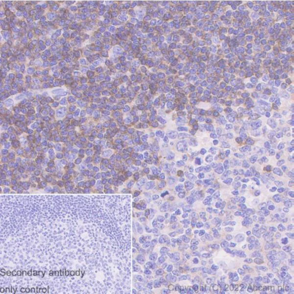 Immunohistochemistry (Formalin/PFA-fixed paraffin-embedded sections) - Anti-CD79b antibody [SP240] - BSA and Azide free (AB245745)