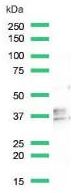 Western blot - Anti-CD79b antibody [SP240] - BSA and Azide free (AB245745), expandable thumbnail