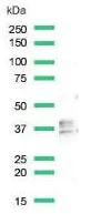Western blot - Anti-CD79b antibody [SP240] - BSA and Azide free (AB245745)