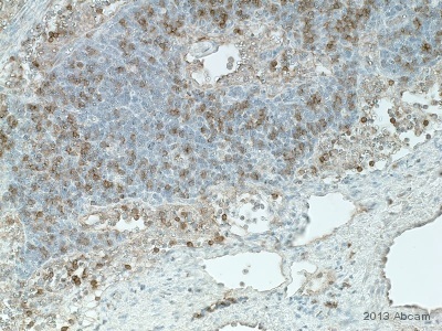 Anti-CD8 alpha antibody - cytotoxic T cell marker (ab4055) | Abcam