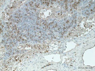 Immunohistochemistry (Formalin/PFA-fixed paraffin-embedded sections) - Anti-CD8 alpha antibody (AB4055)
