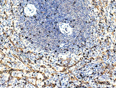 Immunohistochemistry (Formalin/PFA-fixed paraffin-embedded sections) - Anti-CD8 alpha antibody (AB4055)