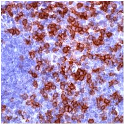 Anti-CD8 alpha antibody - cytotoxic T cell marker (ab4055) | Abcam