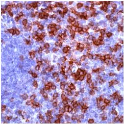 Immunohistochemistry (Formalin/PFA-fixed paraffin-embedded sections) - Anti-CD8 alpha antibody (AB4055)