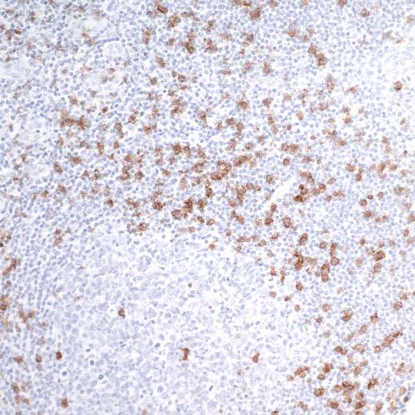 Immunohistochemistry (Formalin/PFA-fixed paraffin-embedded sections) - Anti-CD8 alpha antibody [BLR044F] (AB243900), expandable thumbnail