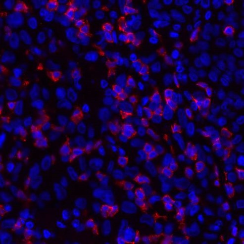 Immunohistochemistry (Formalin/PFA-fixed paraffin-embedded sections) - Anti-CD8 alpha antibody [BLR044F] (AB243900), expandable thumbnail