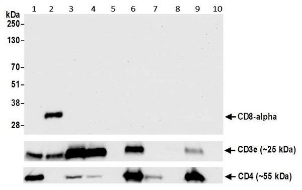 Western blot - Anti-CD8 alpha antibody [BLR044F] (AB243900), expandable thumbnail